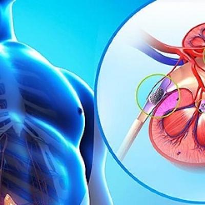 Bệnh thận nên ăn gì?