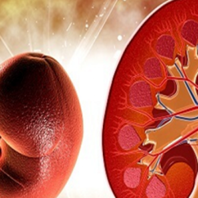 Khắc phục chứng nhiễm trùng thận tại nhà