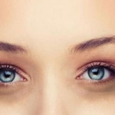 Nguyên nhân và cách khắc phục tình trạng quầng thâm mắt