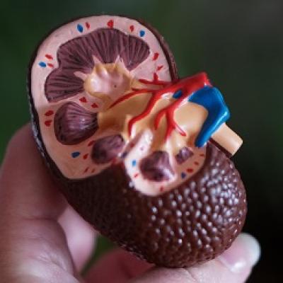 Những sai lầm làm tăng nguy cơ sỏi thận trong dinh dưỡng