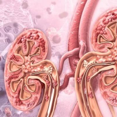 Những thực phẩm cần tránh khi bị bệnh thận